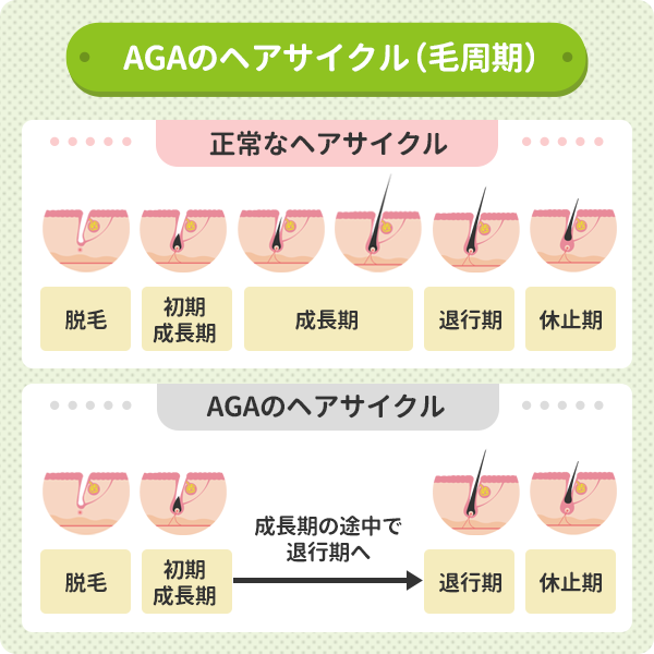 育毛剤は薄毛治療におすすめしない？オンラインAGA治療のメリット | 蒲田西口石川まさとしクリニック