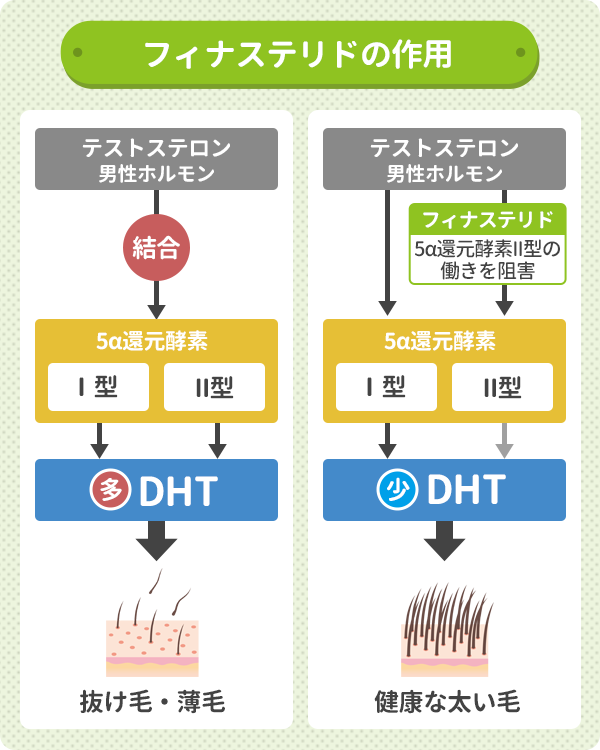 フィナステリドは5α還元酵素の働きを阻害し抜け毛を抑制する効果がある