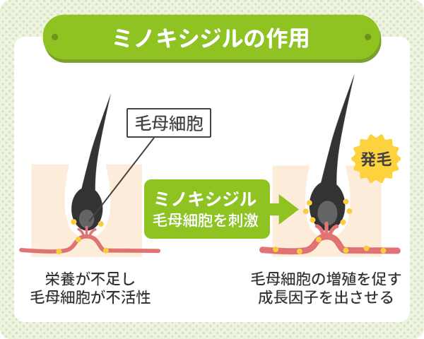 ミノキシジルは毛母細胞を刺激して発毛させる作用がある